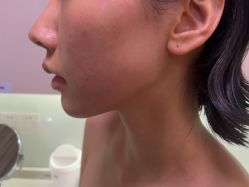 -Yestar艺星整形美容医院