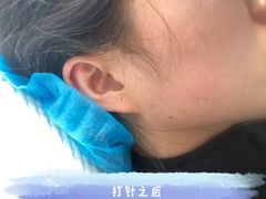 -重庆医科大学附属第一医院(本部)