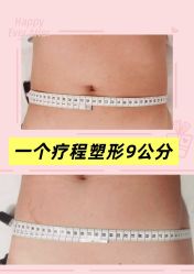-Lily纤美·科技减脂中心
