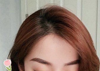 -大麦微针植发丨全国连锁