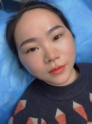 -郡艺医疗美容·微整·眼鼻吸脂