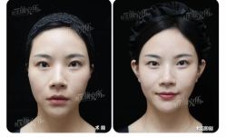 -上海时光整形外科医院