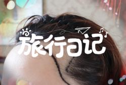 -大麦微针植发全国连锁