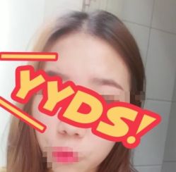 -大麦微针植发丨全国连锁