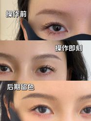 点击看大图 -杨益美学·野生眉半永久纹眉发际线