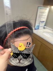 体验前-大麦微针植发全国连锁