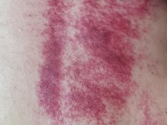 -沈师傅盲人按摩工作室(密三小区店)