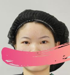 -天津健丽·去眼袋医疗美容机构
