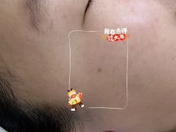 体验前-张小熊连锁轻医美
