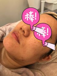 体验前-星和深湾荟医疗美容