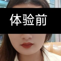 体验前-南宁华美医疗美容医院