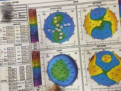 -美尔目眼科医院·近视手术·儿童近视(通州店)