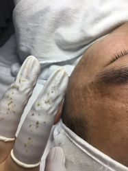 -痘敏医生专业祛痘连锁