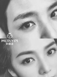 -MLP美丽派·问题肌疗愈中心