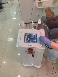 -大麦微针植发丨全国连锁