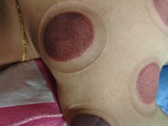 -益友堂盲人推拿正骨穴位按摩工作室