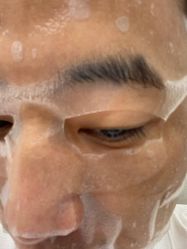 体验后-和颜一美轻医美连锁