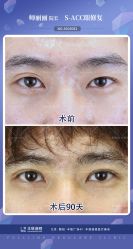 -丰联丽格医疗美容·联合丽格眼整形中心