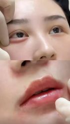 -东莞西妃整形美容医院