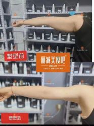 -丽减美瘦吧·减肥瘦身