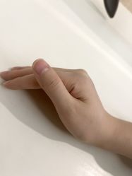 -清疣美疣·痣·斑净肤中心