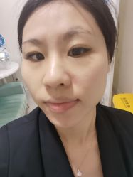 点击看大图 体验后-深圳美莱医疗美容医院