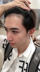 点击看大图 -大麦微针植发丨全国连锁