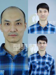 -型男帮男士假发补发·佩戴式发型