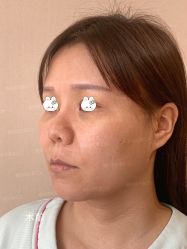 -北京米扬丽格医疗美容·联合丽格鼻整形中心