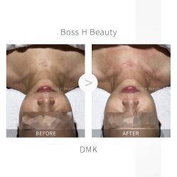 -Boss H Beauty美肌中心