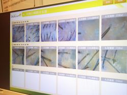 -LESSMORE科技头皮理容中心