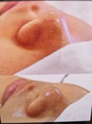 -SKIN79皮肤管理中心