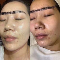 -苗方清颜痘肌研究所