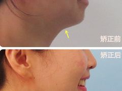 -柏乐口腔(南宁总院)