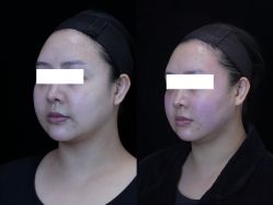 -Yestar重庆艺星医疗美容医院