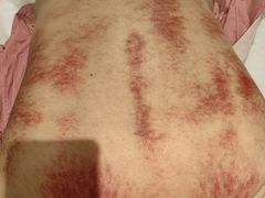 -阮氏中医推拿·颈肩腰腿(世纪公园店)