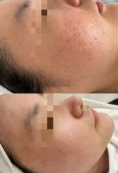 -康美贞·痘肌养护管理中心