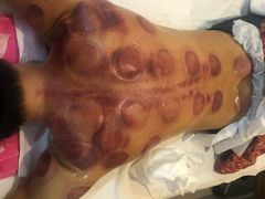 -益友堂盲人推拿正骨穴位按摩工作室