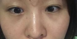 -More摩尔医美の注射线雕光电中心