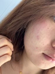 -北京润美玉之光医疗美容
