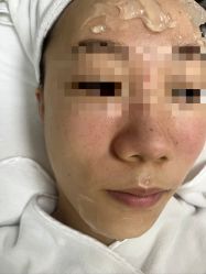 -元熙兰积皮肤管理