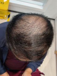 -雍禾植发全国连锁