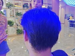-碧莲盛·不剃发植发