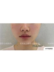 -杭州米兰柏羽医疗美容医院