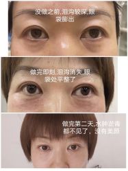 -贝黎诗SPA