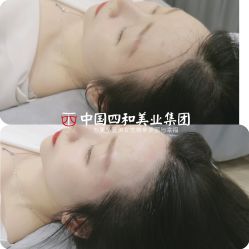 点击看大图 -西施无菌半永久纹绣眉眼影唇轻增发纹发际线
