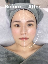 -VE专注问题肌·赛诺龙&科学美肤中心