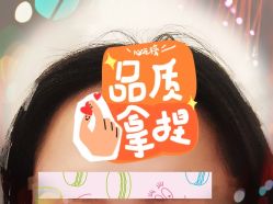 -大麦微针植发全国连锁