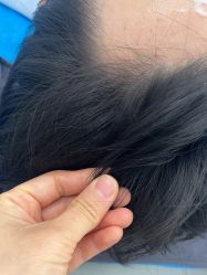 -熙朵美学植发·连锁品牌