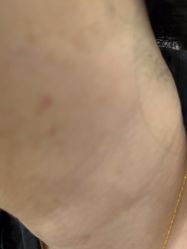 -美瑞莎创美医疗美容